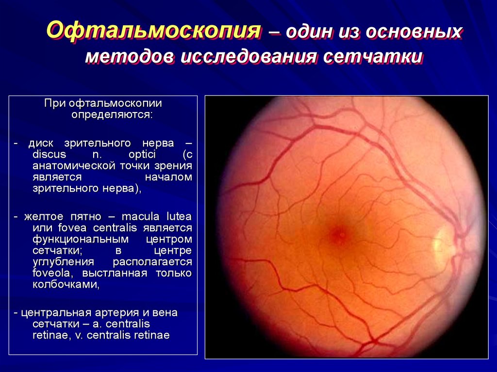 Офтальмоскопическая картина нормального глазного дна характеризуется