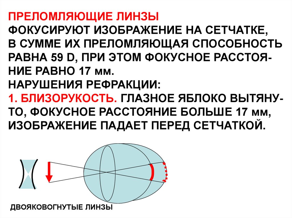 Преломляющие структуры. Преломляющая линза. Преломляющая способность линзы. Преломляющая способность. Фокусирует изображение на сетчатку.