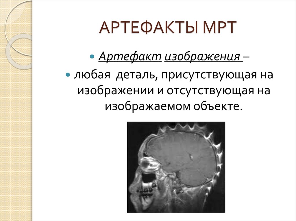 Режимы мрт презентация