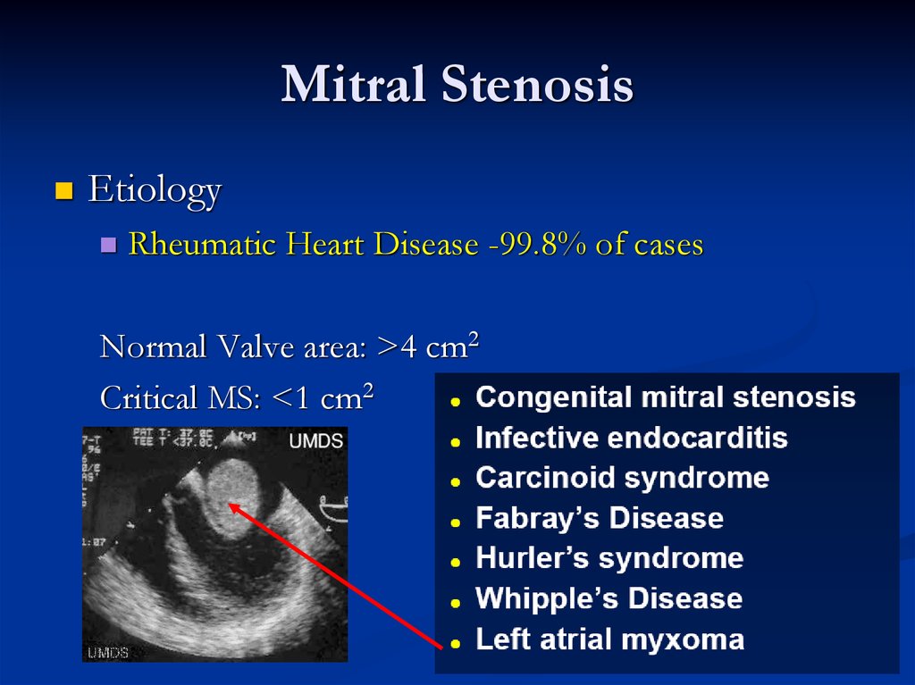 valvular-heart-diseases-online-presentation