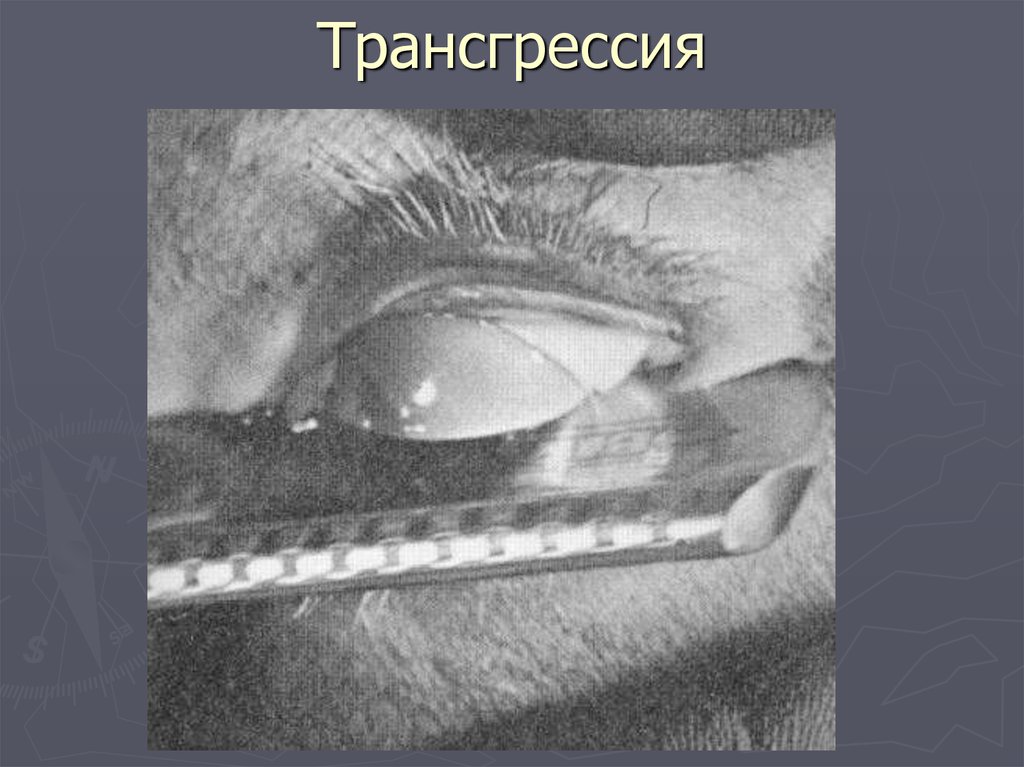Трансгрессия