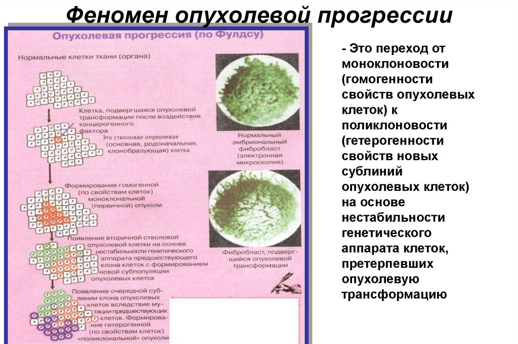 Реферат: Патология тканевого роста Опухоли