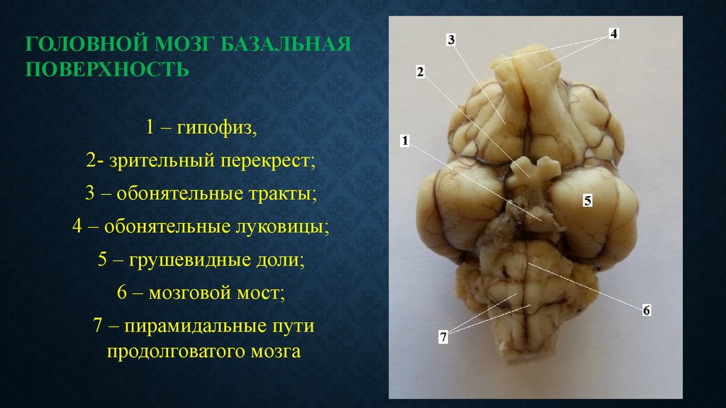 Обонятельные доли мозга. Базальная поверхность головного мозга. Структуры базальной поверхности мозга. Головной мозг КРС С базальной поверхности. Головной мозг базальная поверхность с долями.