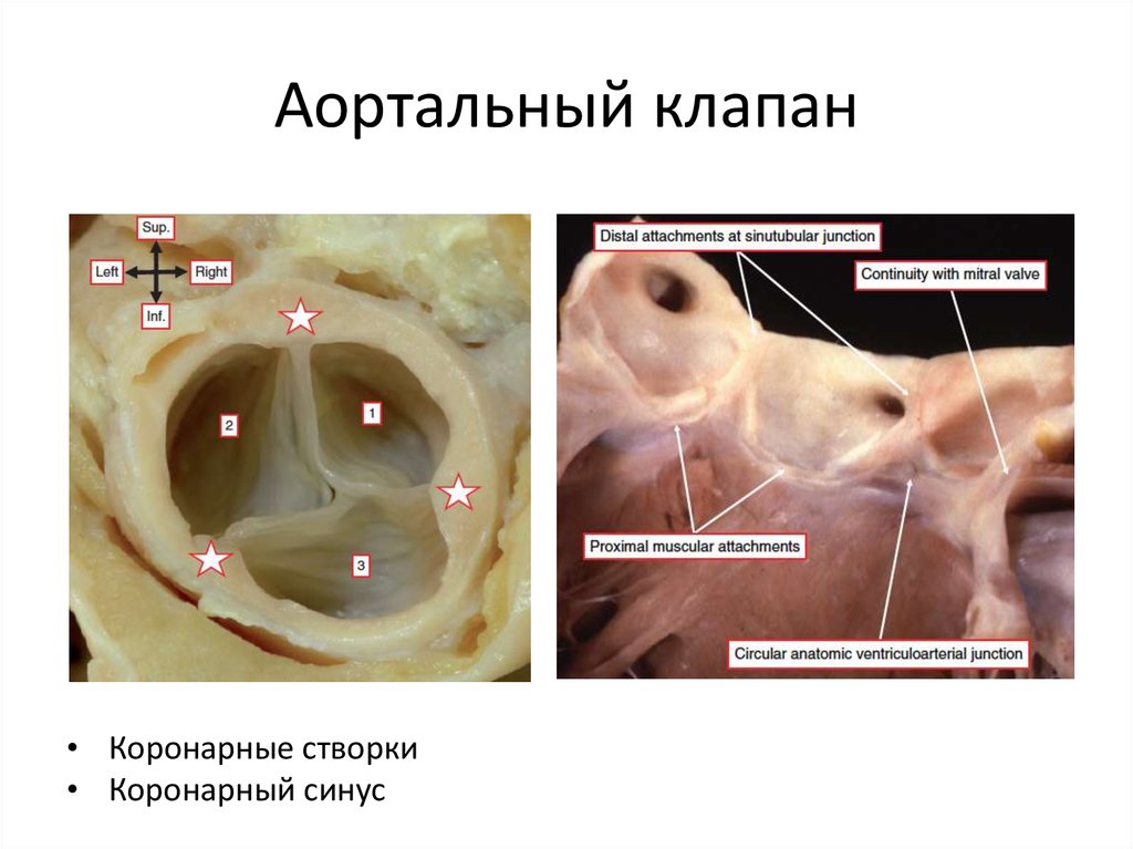 Площадь отверстия аортального клапана