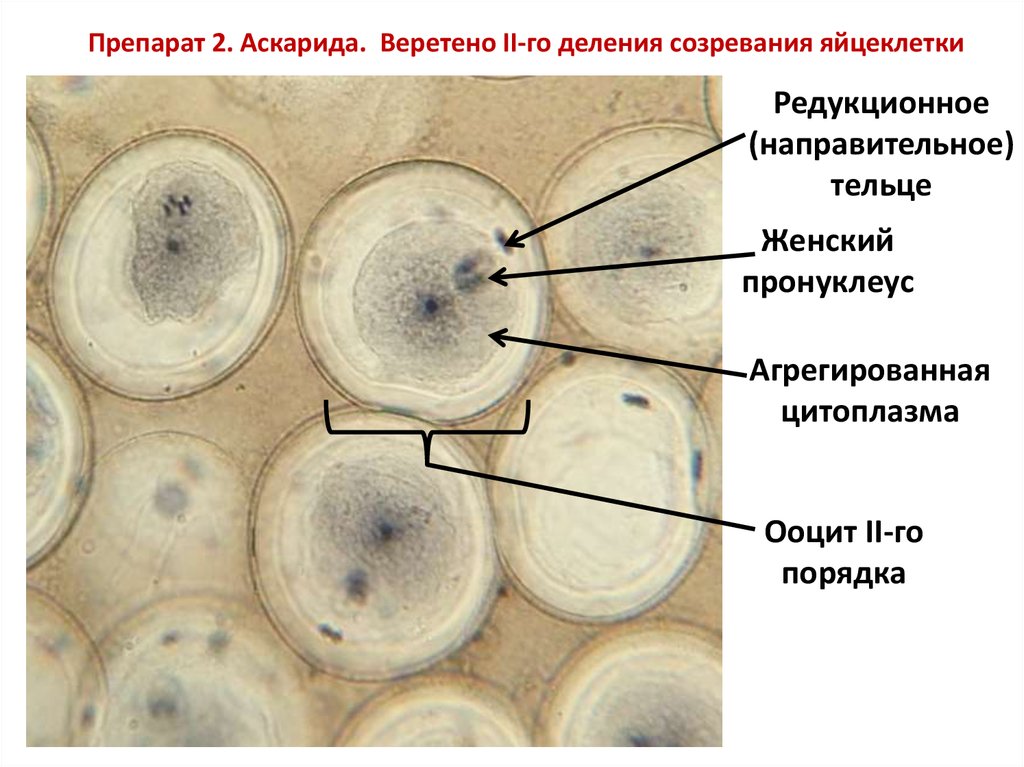 Яйцеклетка подсолнечника. Пронуклеус.