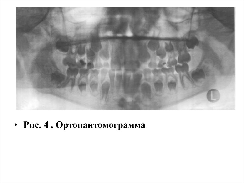 Рентгенодиагностика в стоматологии презентация