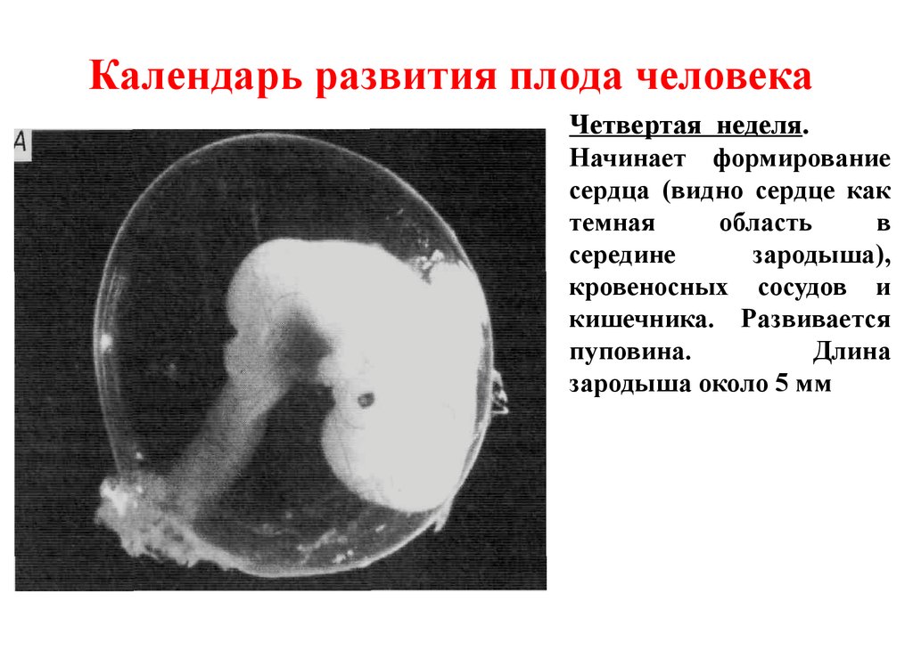 Эмбрион 4 недели. Зародыш человека 4 недели. Эмбрион человека 4 недели. Зародыш человека в норме развивается в:.