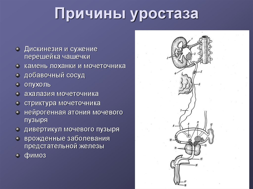 Травмы мочеточника презентация