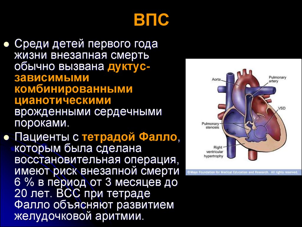 Врожденный порок сердца. Врожденный порог сердца. Врожденныепопроки сердца. Врожденный порок сердца (ВПС). Врождённые пороки ердца.