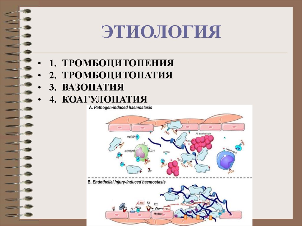 Патофизиология гемостаза. Этиологиятромбоцитопений.. Тромбоцитопения этиология. Тромбоцитопатия этиология. Патофизиология системы гемостаза тромбоцитопатии.