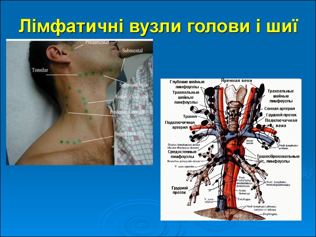 Где Располагаются Лимфоузлы На Шее Фото