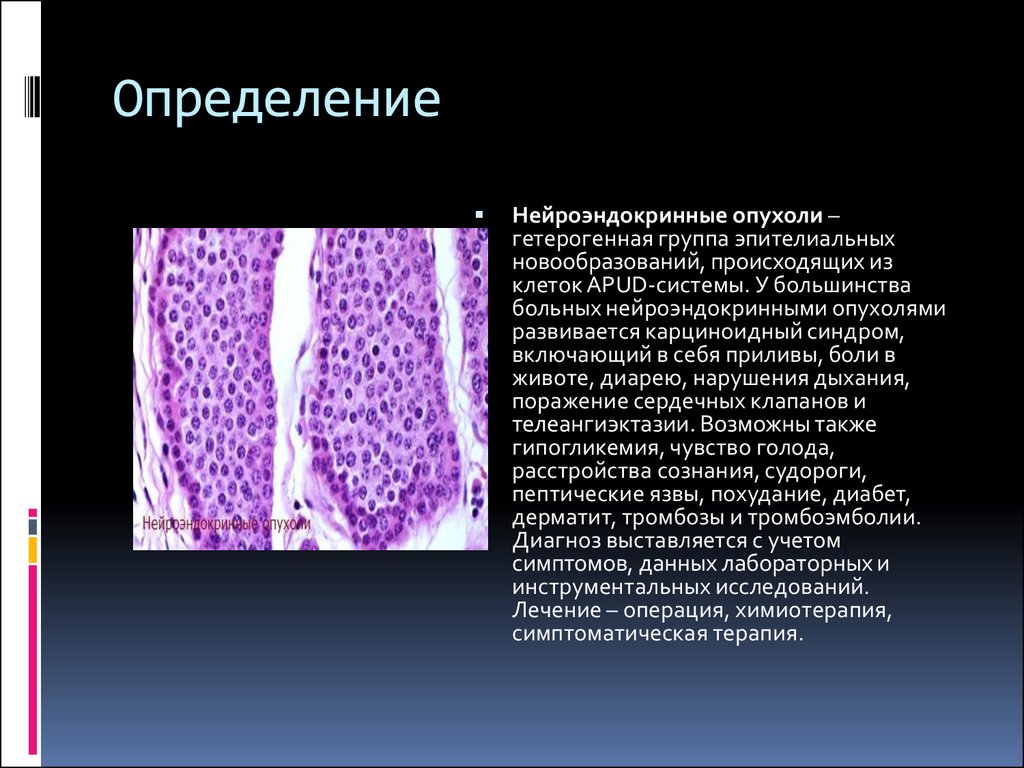 Нейроэндокринные опухоли презентация