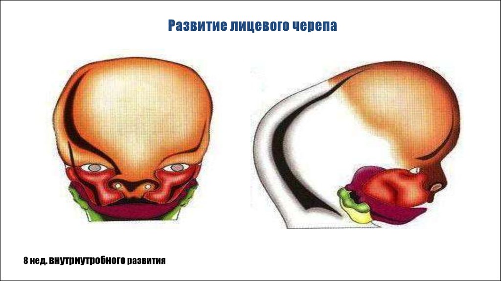 Врожденные аномалии костей черепа нмо ответы