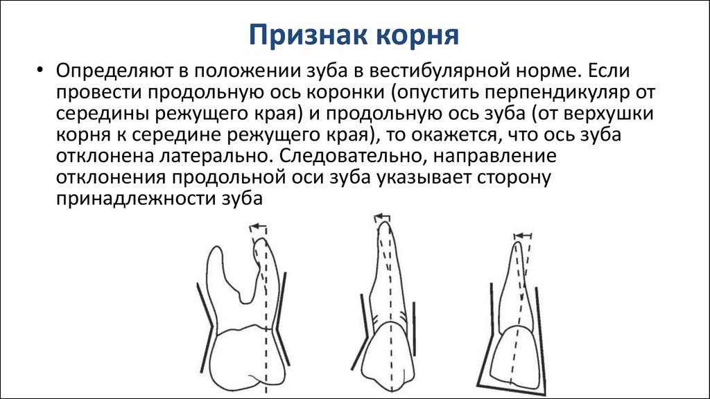 Признаки коронки зуба. Признак угла коронки зуба. Признаки принадлежности зуба поверхности коронки зуба. Признак отклонения верхушки корня. Признак кривизны коронки зуба.