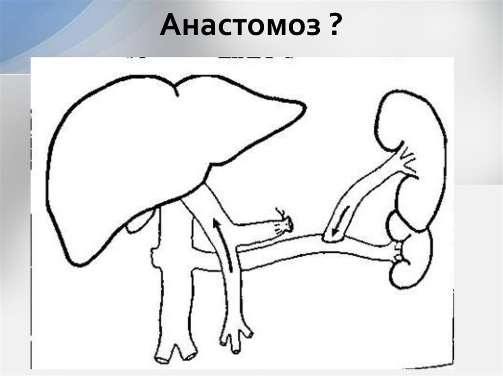 Анастомоз ?