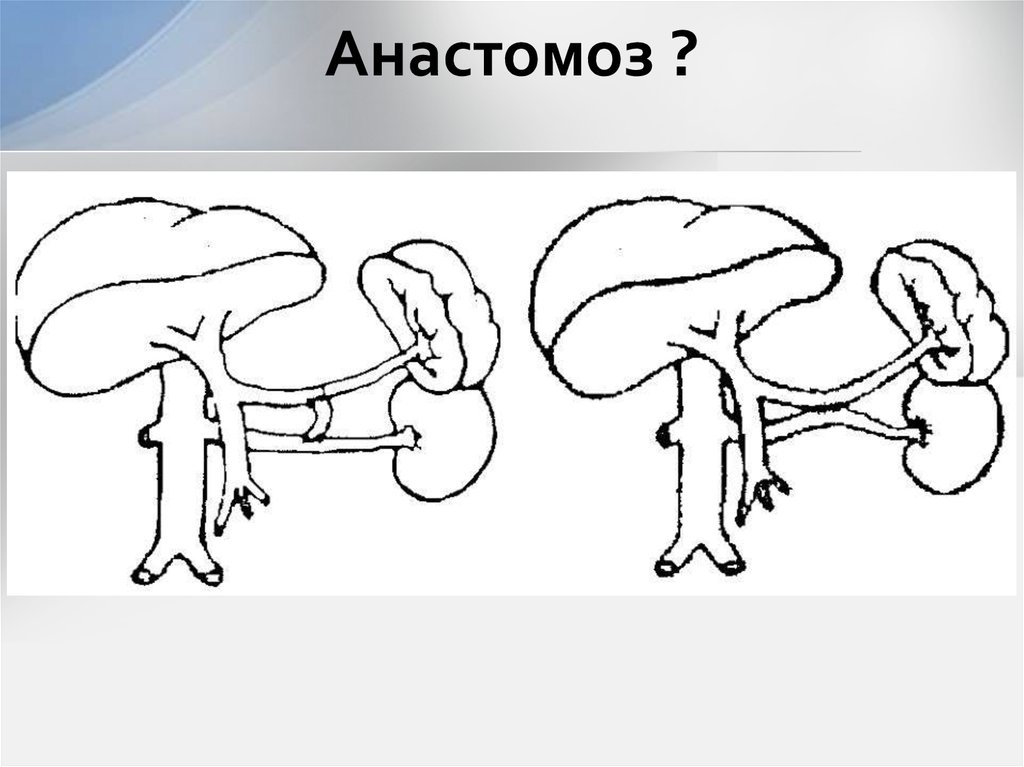 Анастомоз ?