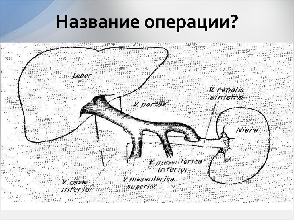 Название операции?