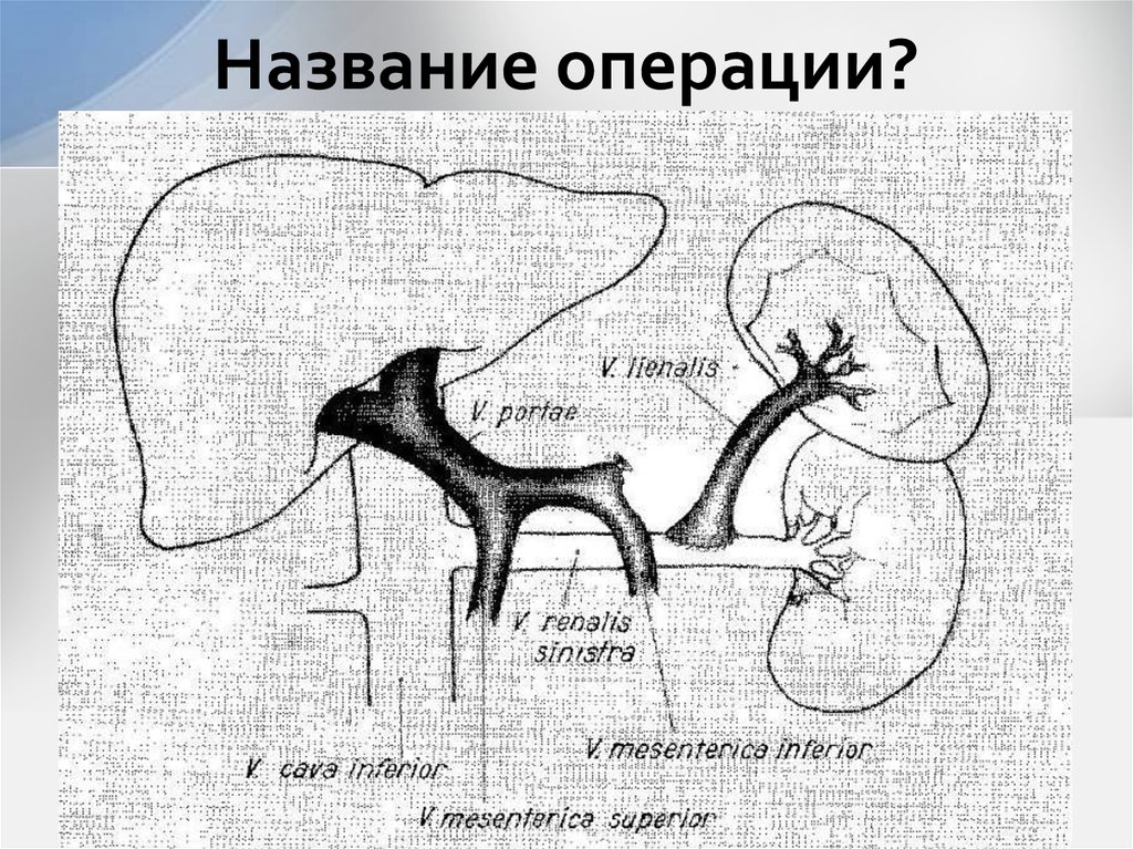 Выберите название операции