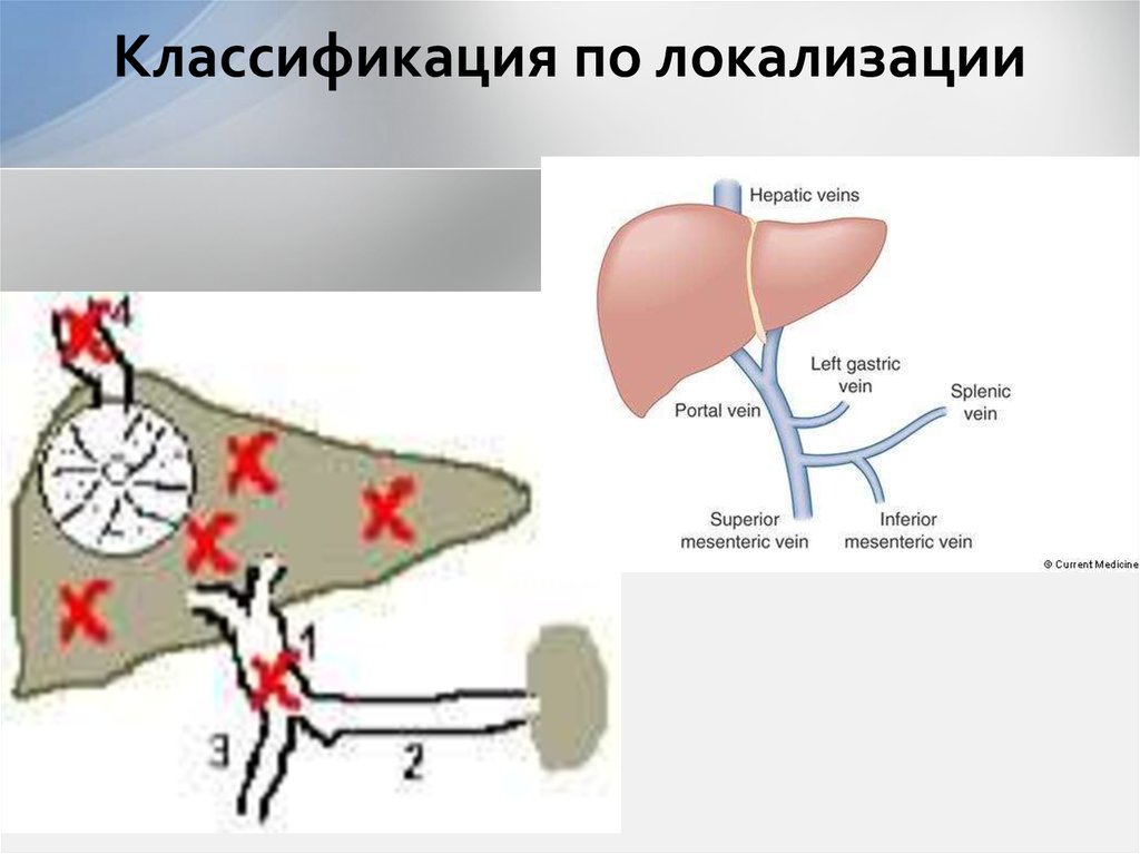 Классификация по локализации