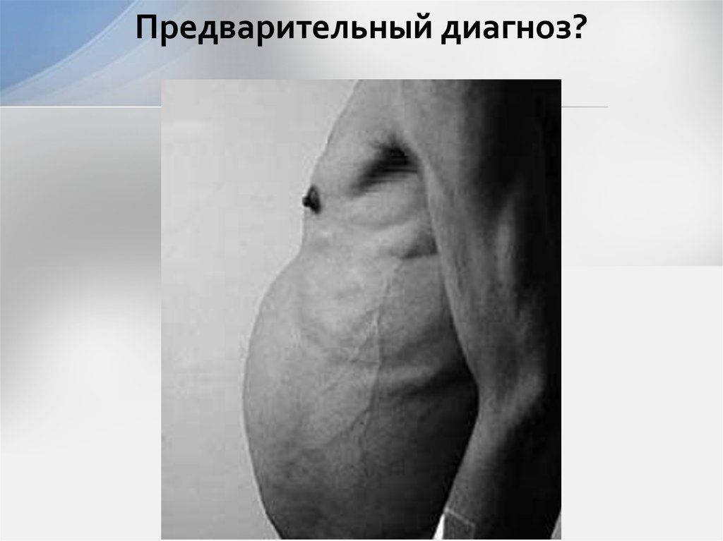 Предварительный диагноз?