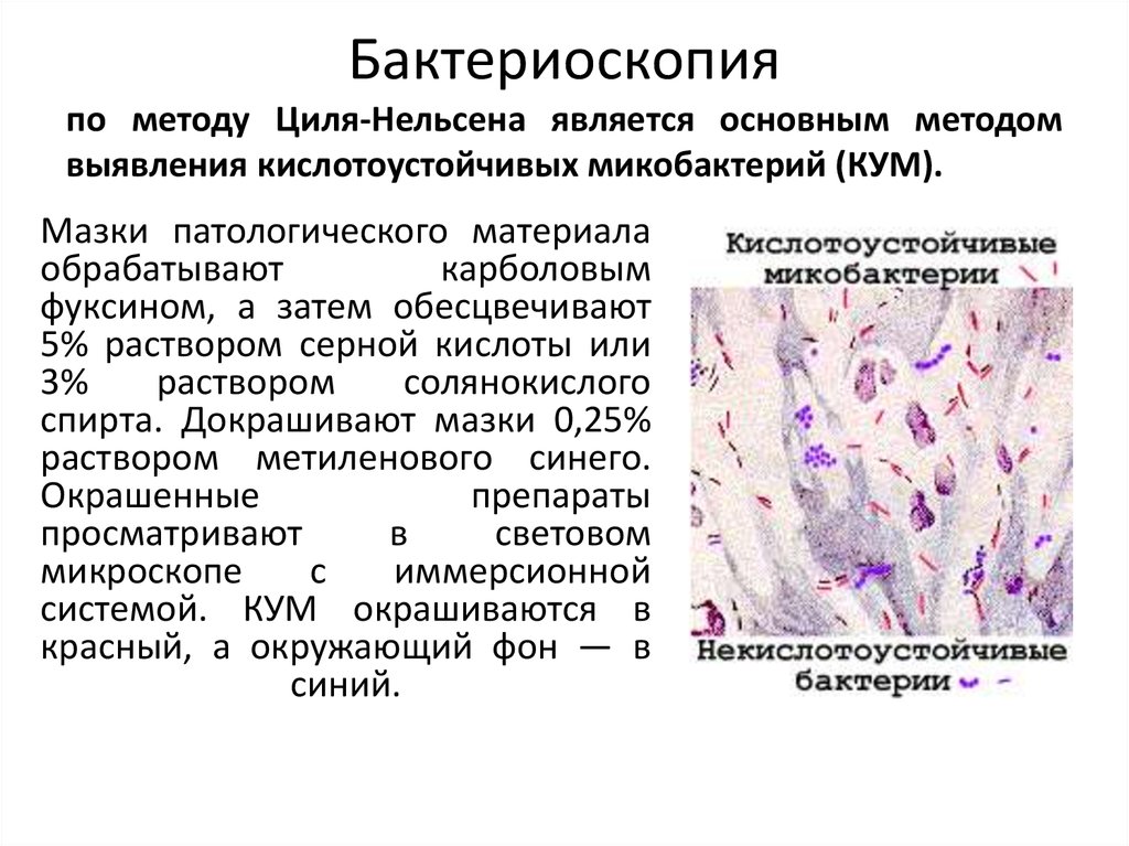 Кишечная палочка вызывает заболевания. Бактериоскопический метод исследования микрофлоры. Бактериоскопический метод e.coli. Бактериоскопия мазка туберкулез. Энтерогеморрагические кишечные палочки.