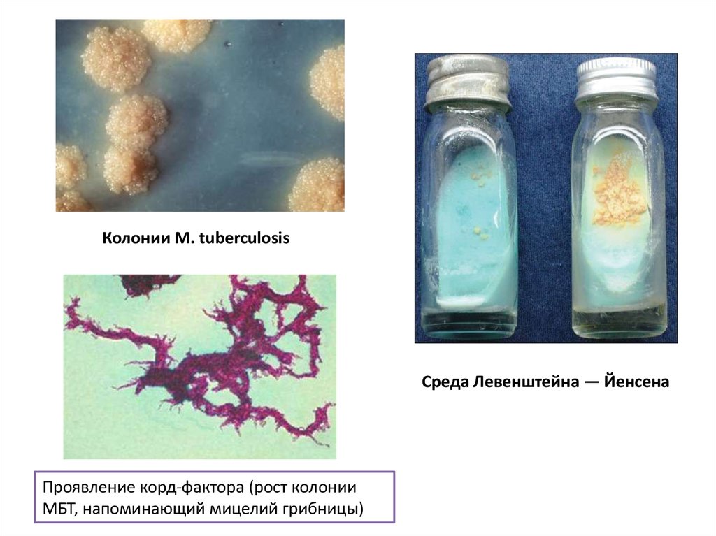 Анализ мокроты на микобактерии. Среда Левенштейна-Йенсена туберкулез. Рост микобактерий на среде Левенштейна Йенсена. Микобактерии туберкулеза на среде Левенштейна Йенсена. Микобактерия туберкулеза на среде Левенштейна.