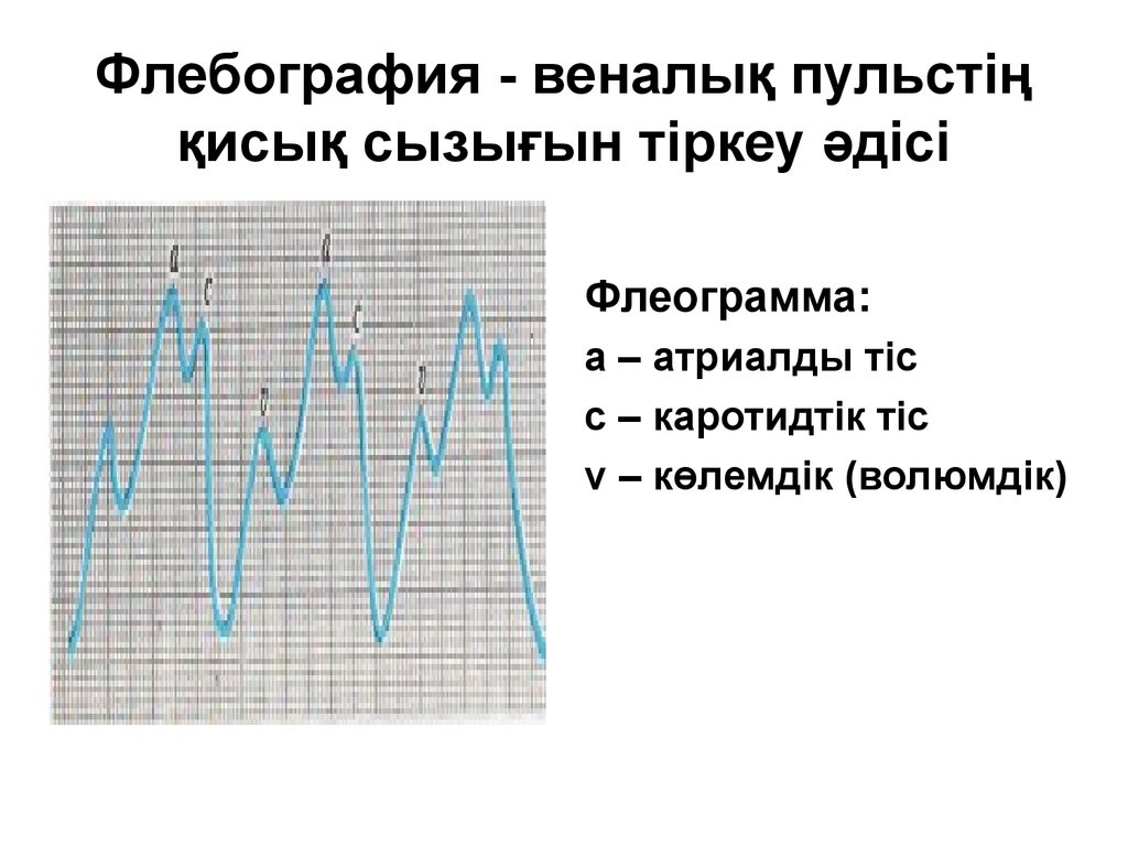 Флебография вен нижних. Флебограмма физиология. Флебография презентация.