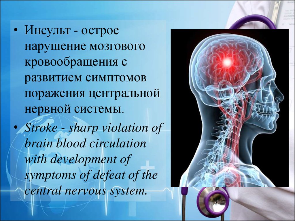 Нарушение кровообращения цнс. Инсульт острое нарушение мозгового кровообращения. Симптомы инсульта презентация.