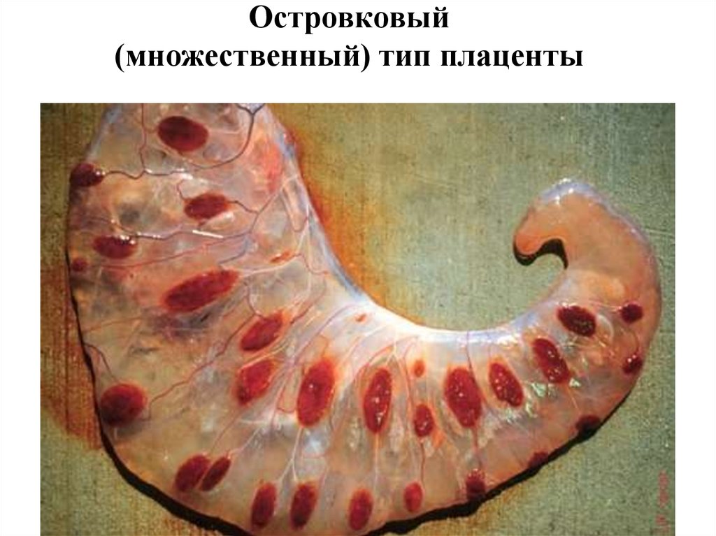 Островковый (множественный) тип плаценты