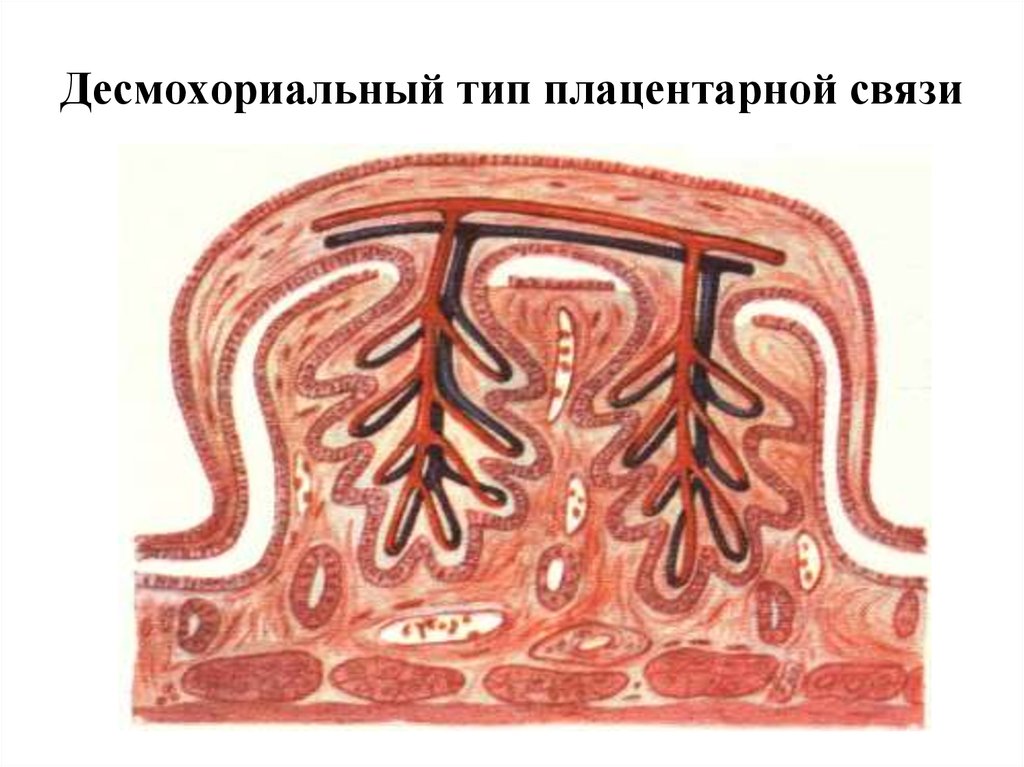 Типы плацент презентация