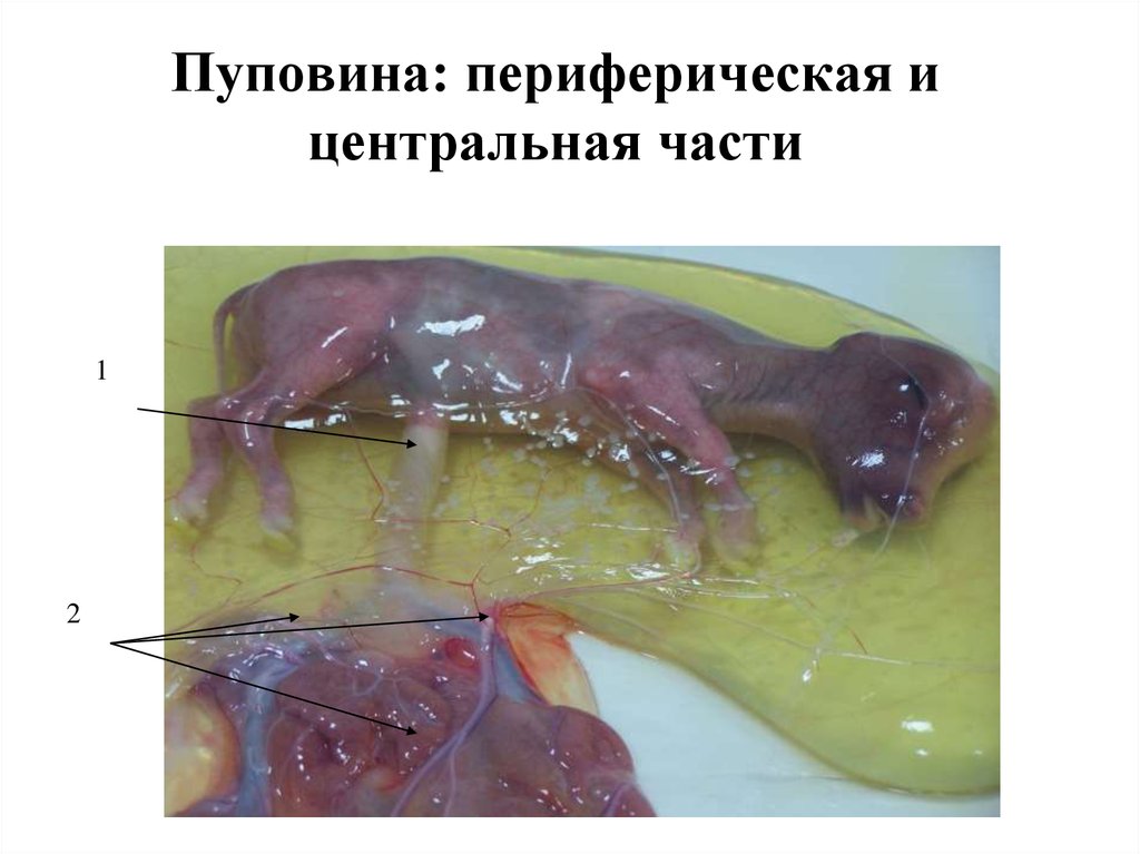 Пуповина: периферическая и центральная части