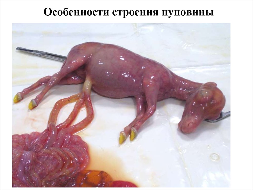 Особенности строения пуповины