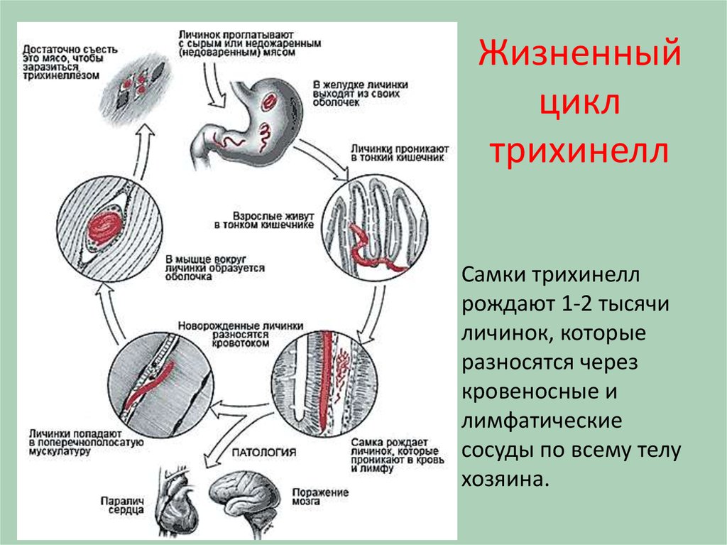 Схема жизненного цикла трихинеллы