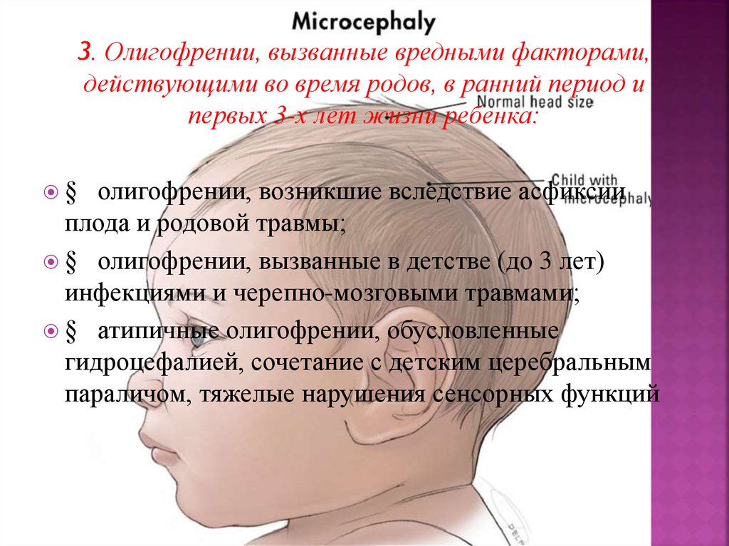 Презентация на тему классификация умственной отсталости