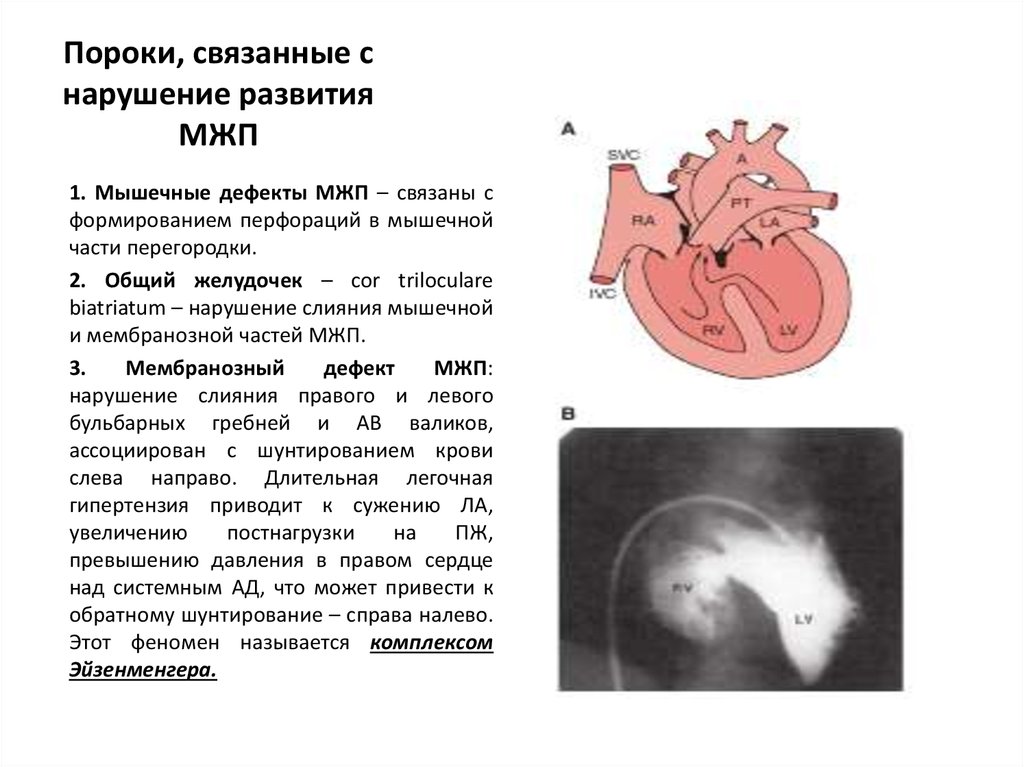 Дмжп у плода