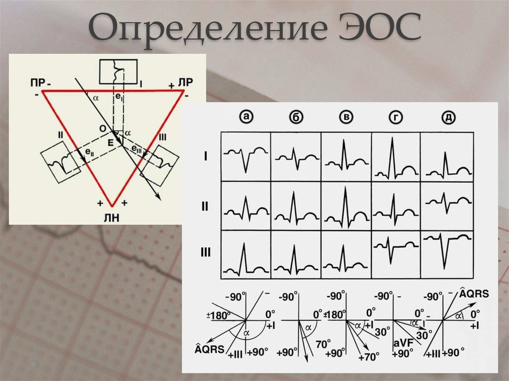 Определение ЭОС