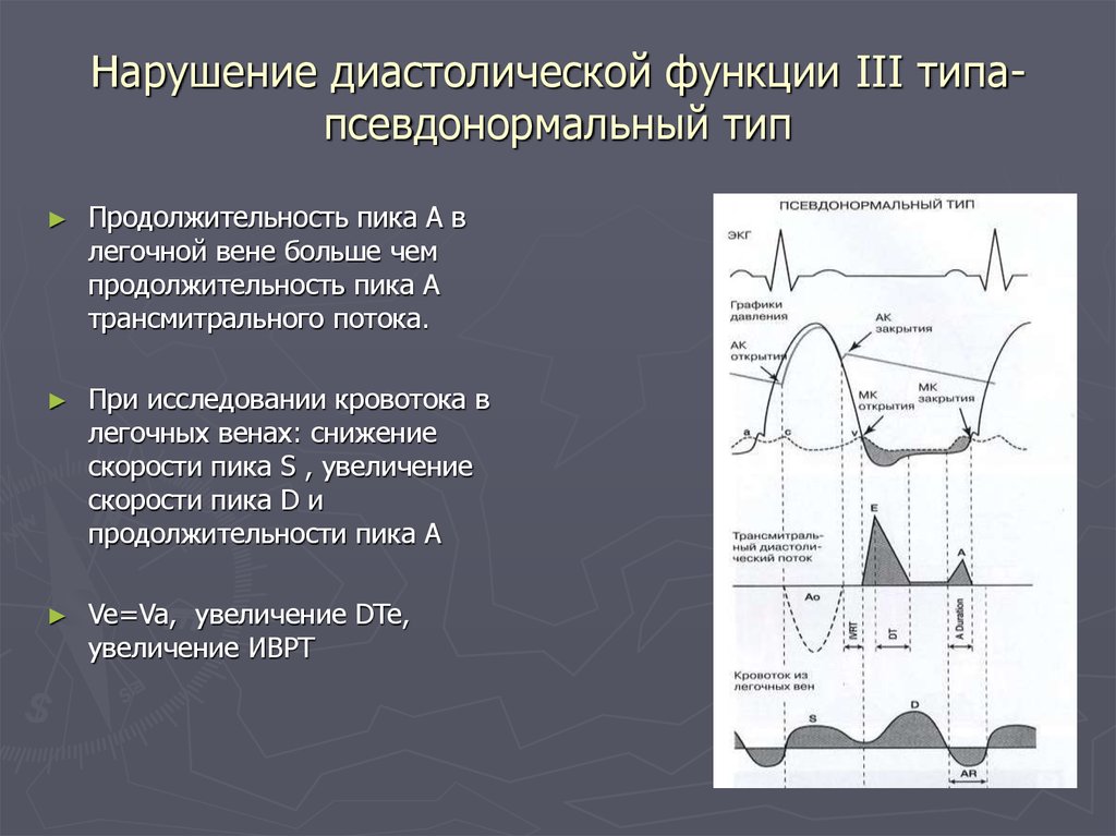 Диастолическая левого желудочка. Типы нарушения диастолической функции лж. Трансмитральный кровоток норма. ЭХОКГ показатели диастолической функции. Типы нарушения диастолической функции левого желудочка.