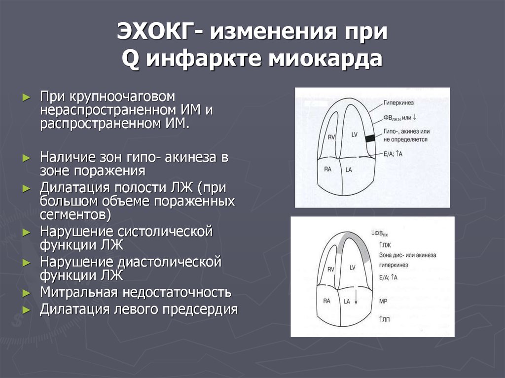 Эхокг в таблицах и схемах рыбакова