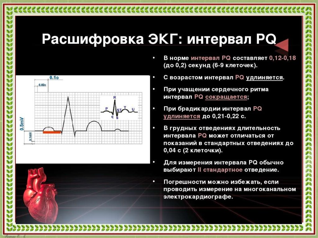 Тяжелое экг. PQ QRS qt сердца нормальные показатели. Нормальные показатели интервалов ЭКГ. Продолжительность интервалов ЭКГ В норме. PQ,130 расшифровка ЭКГ.