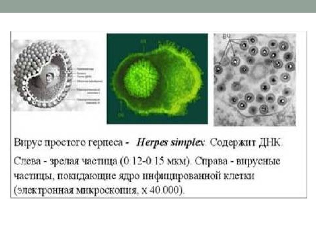 Вирус герпеса презентация по биологии