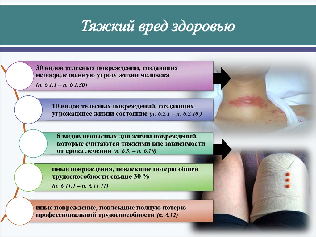 Легкие телесные повреждения. Виды тяжкого вреда здоровью. Повреждения с тяжким вредом здоровью. Тяжесть телесных повреждений.