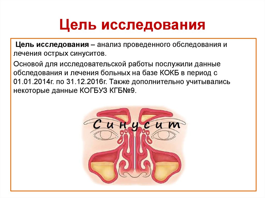 Частые синуситы