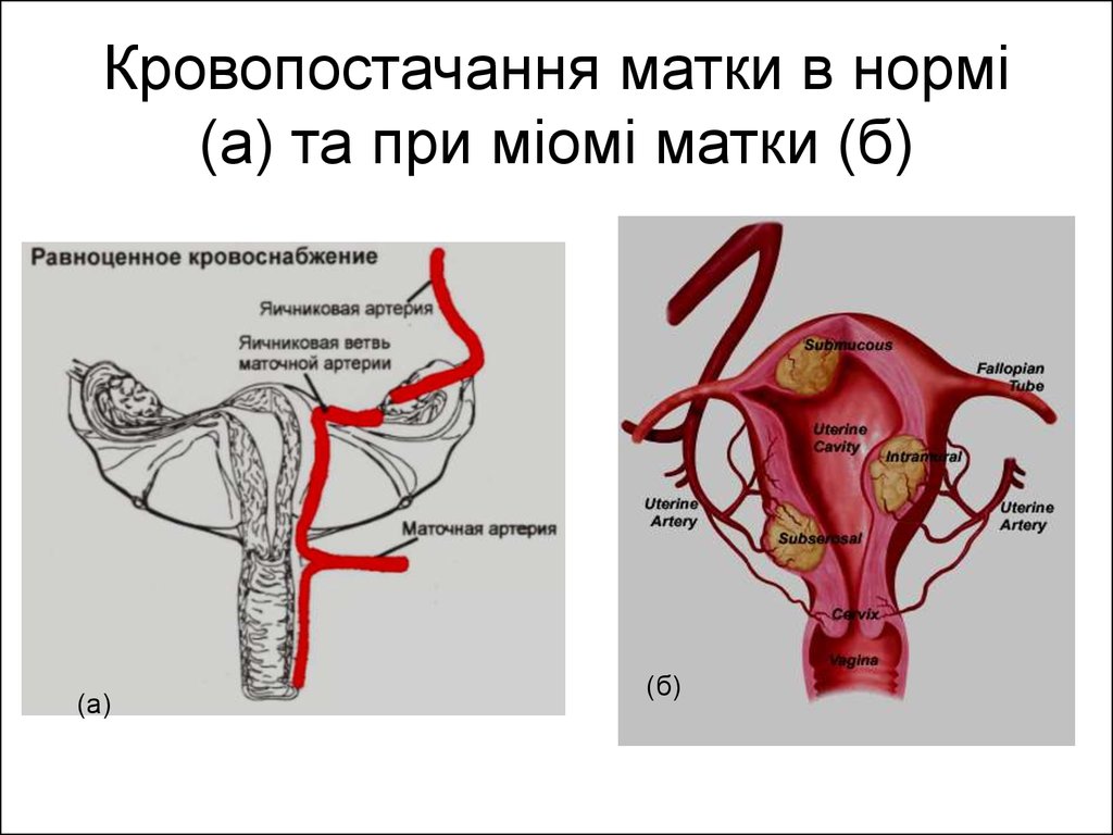 Маточная артерия. Кровоснабжение матки и яичников. Кровоснабжение матки схема. Кровоснабжение яичника и матки. Кровоснабжение матки и яичников схема.