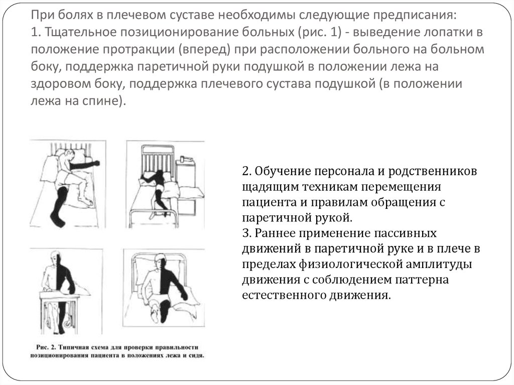 Контрактура инсульт