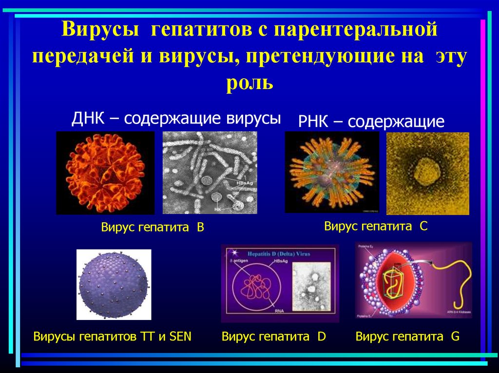 Вирусные гепатиты e. Вирус гепатита с возбудитель. Вирус гепатита в. Вирусный гепатит а возбудитель. Парентеральные вирусы гепатита.