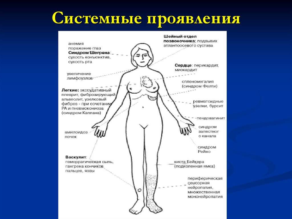 Системные проявления