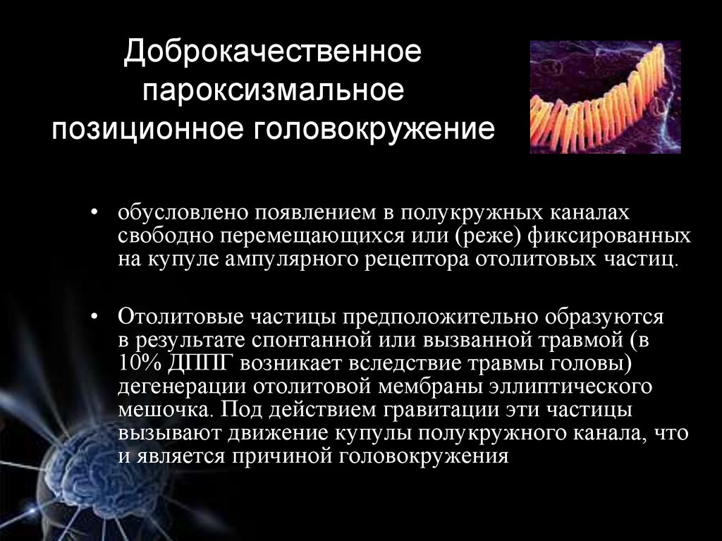 Позиционное головокружение. Доброкачественное пароксизмальное головокружение. ДППГ отолиты. Доброкачественное пароксизмальное головокружение диагноз. ДППГ доброкачественное пароксизмальное позиционное головокружение.