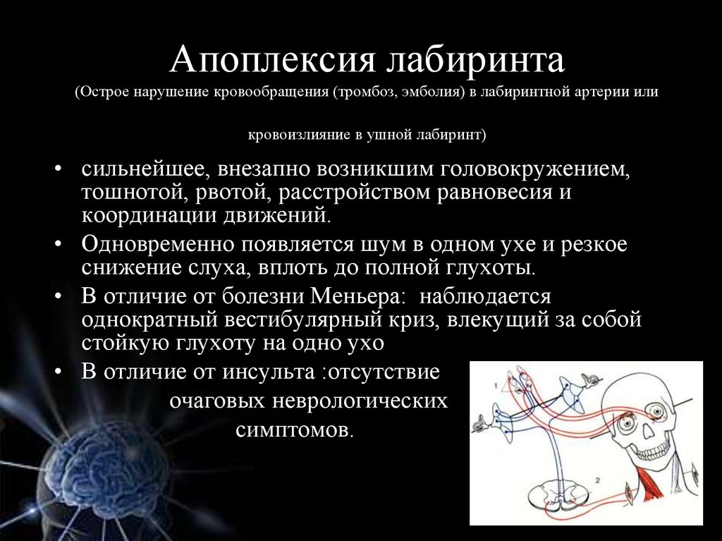 Вестибулярный криз карта вызова