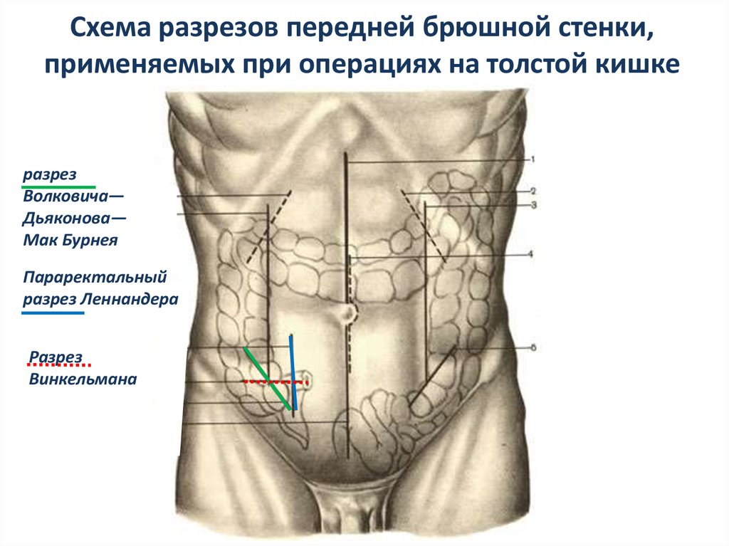 Проекция слепой кишки