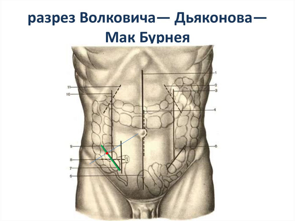 Мак бурнея